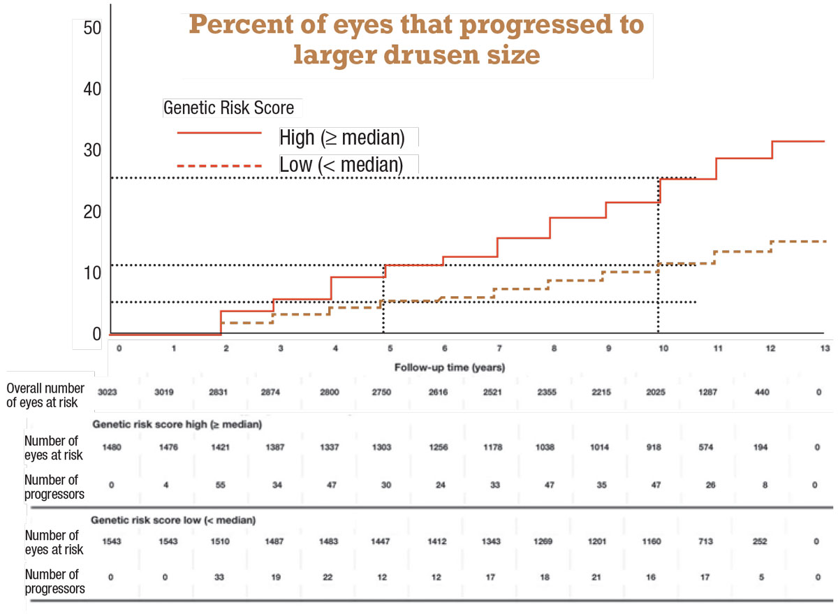 Figure 2. Kaplan-Meier curves for the probability of eyes progressing to larger drusen size (two  steps) by follow-up time according to high or low Genetic Risk Score. (Reprinted with permission: Investigative Ophthalmology & Visual Science). 