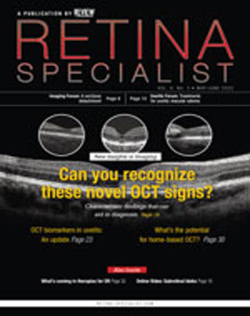 Retina Specialist