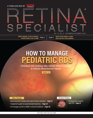 Retina Specialist
